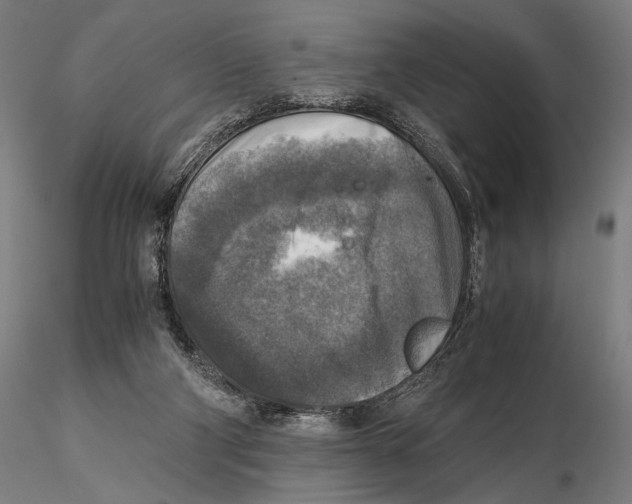 X0000115510114200912041111