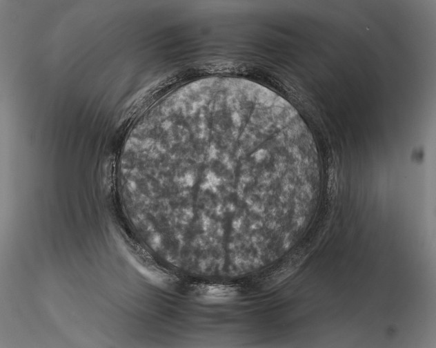 X0000115510165200912041110