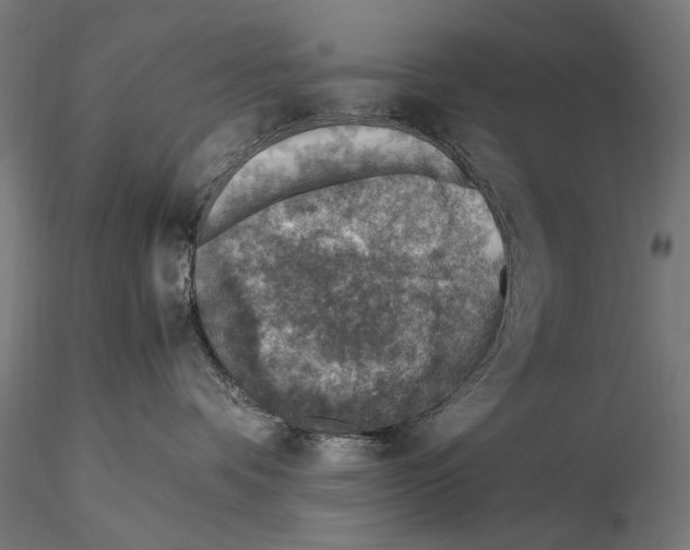 X0000115510336200912041107