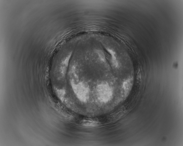 X0000115510559200912041104