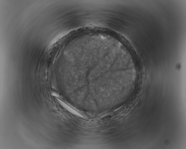 X0000115510919200912041058