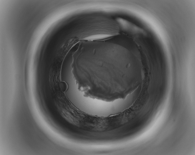 X0000115520143200911061425