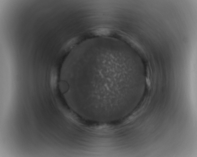 X0000115520600200911061419