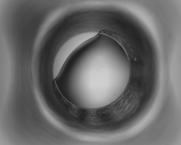 X0000115520766200911061417