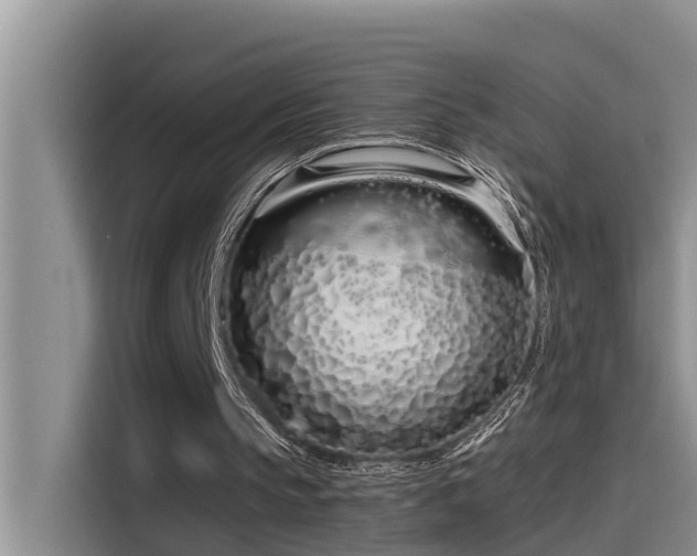 X0000115520145200911131452