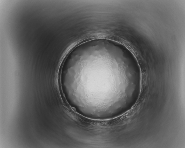 X0000115520147200911131452