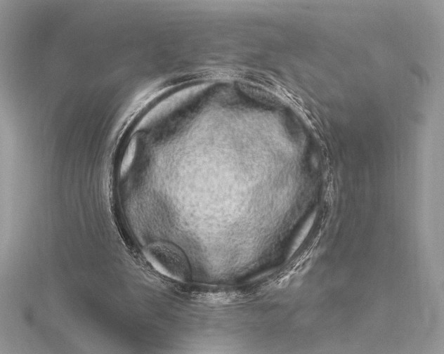 X0000115520103200911201707