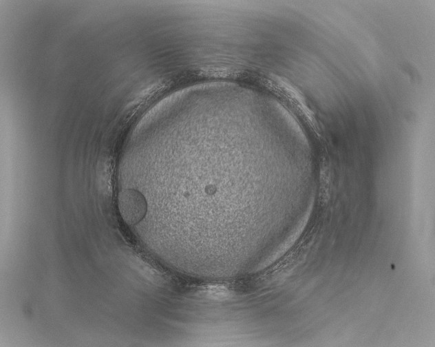 X0000115520114200911201707