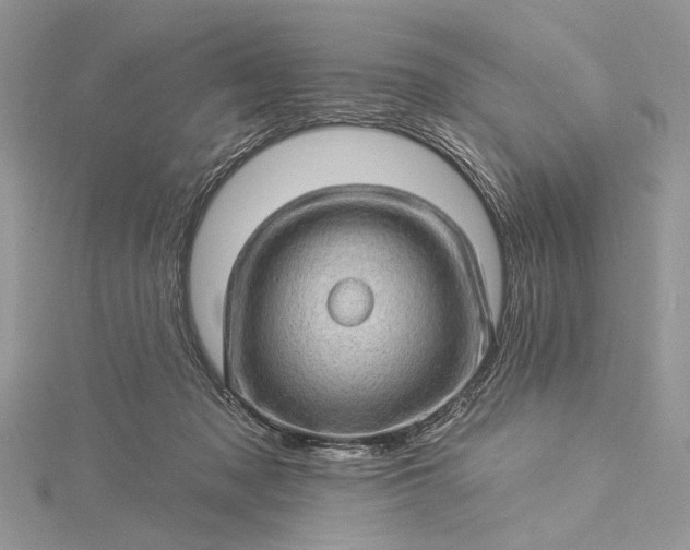 X0000115520317200911201704