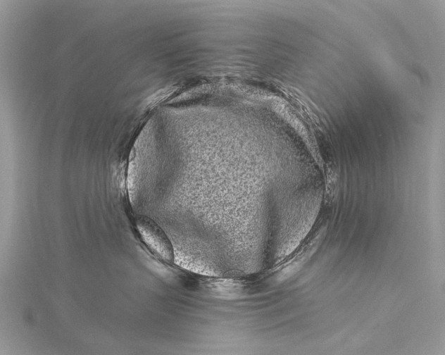 X0000115520383200911201704