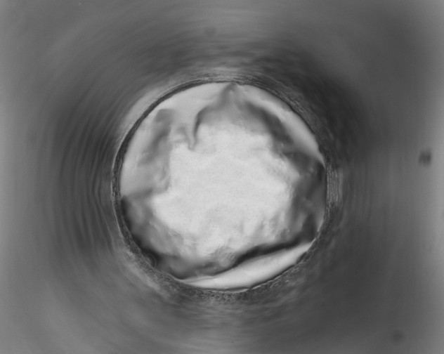 X0000115520147200911271330