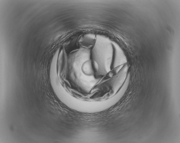 X0000115520965200912040925