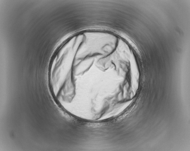 X0000115521237200912040922