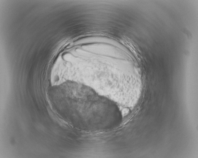 X0000115520145200912181513