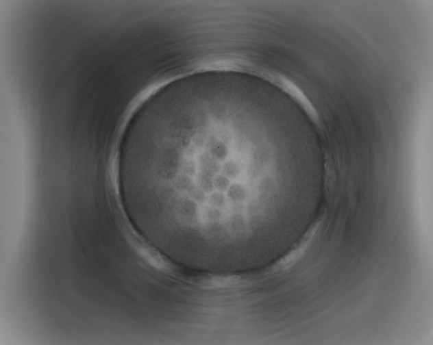 X0000115531035200911061436