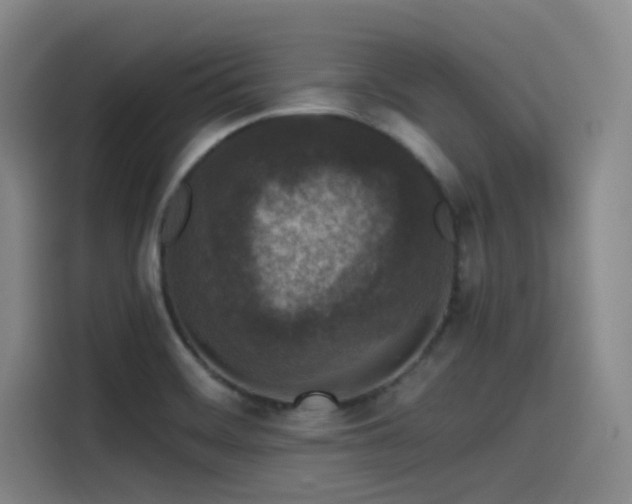 X0000115531468200911061430