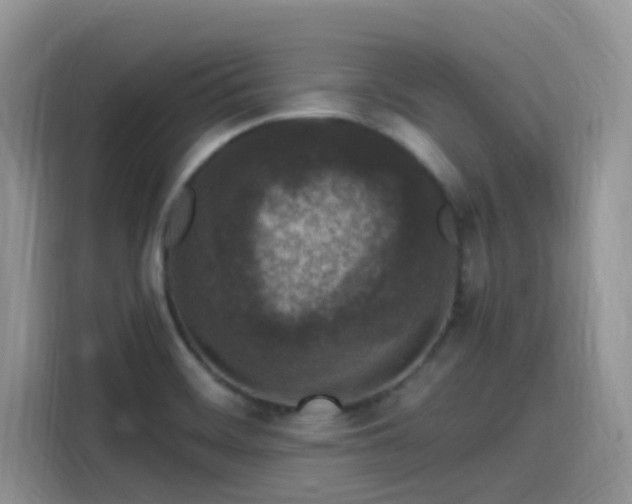 X0000115531468200911131455