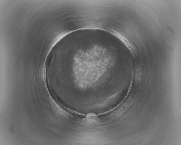 X0000115531468200912040939