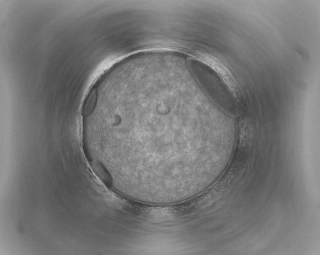 X0000115531472200912040939