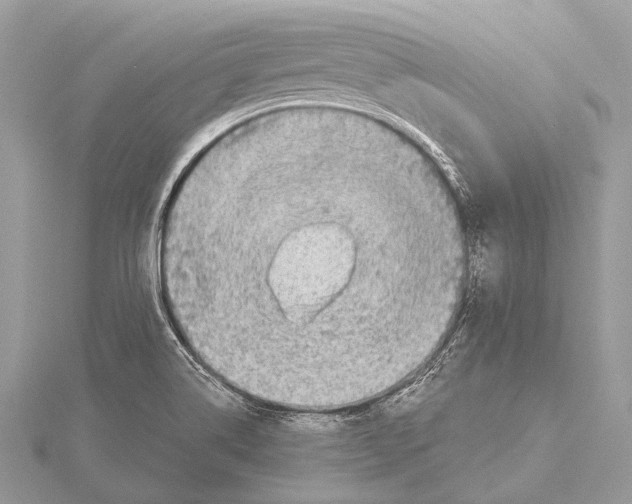 X0000115531514200912040938