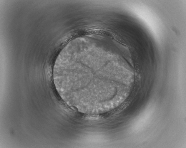 X0000115540767200912041010