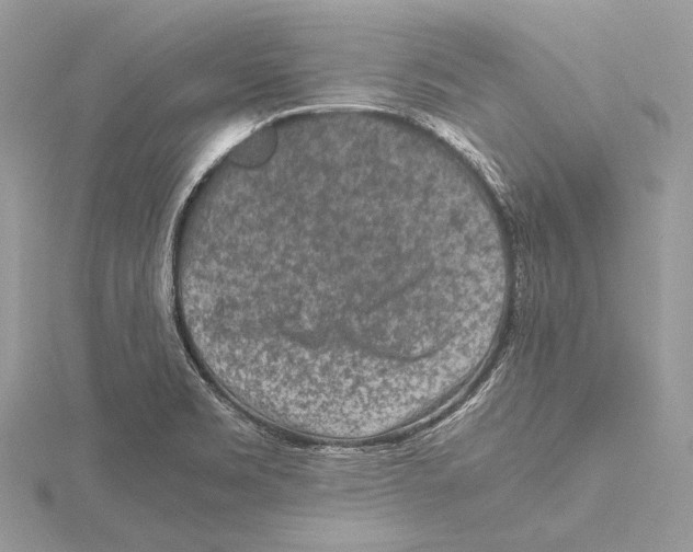 X0000115541469200912041000