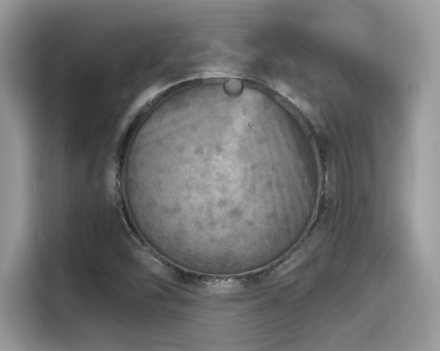 X0000115551454200911131554