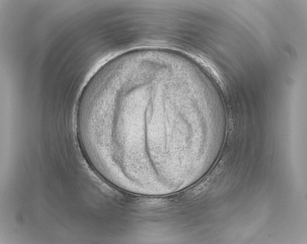 X0000115551382200912041023