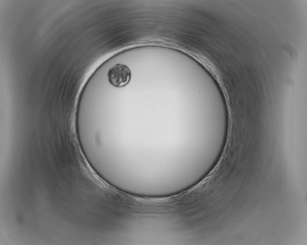 X0000115561296200911061140