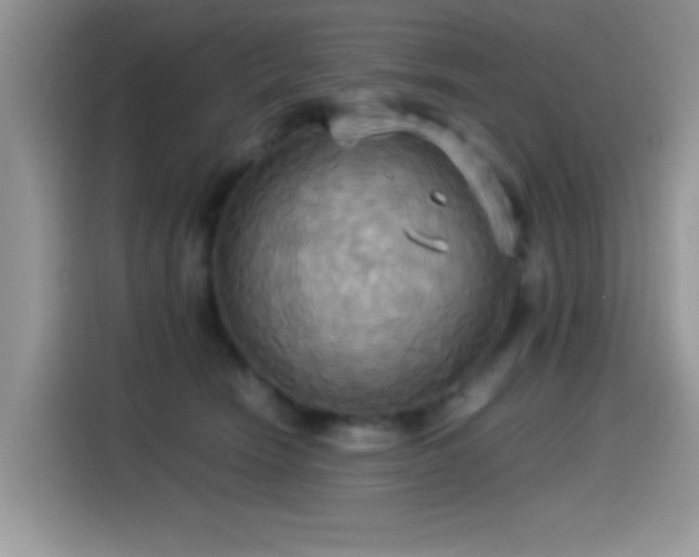 X0000115560466200911061556