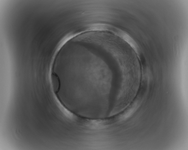 X0000115560803200911061552