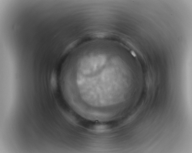 X0000115560216200911131633