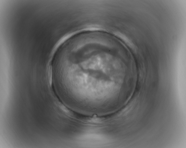 X0000115561175200911131621