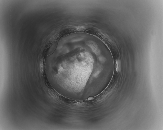 X0000115561395200911131617