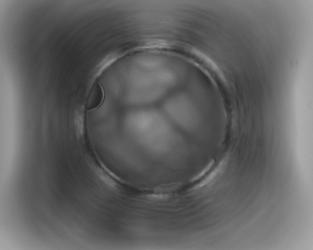 X0000115561409200911131617