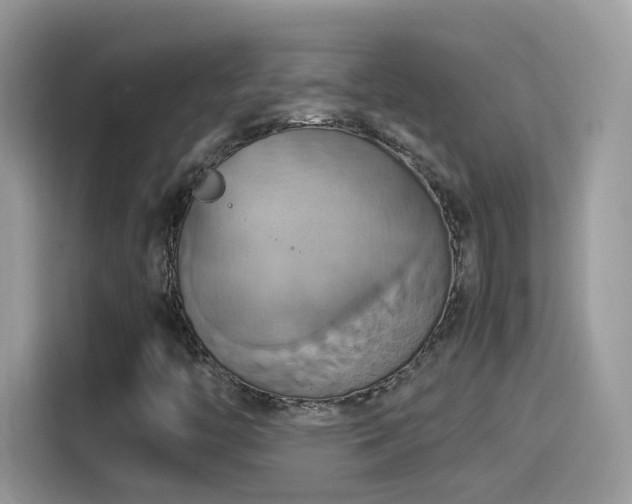 X0000115561446200911131617