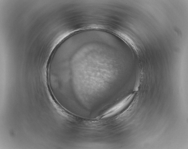 X0000115561047200911201818