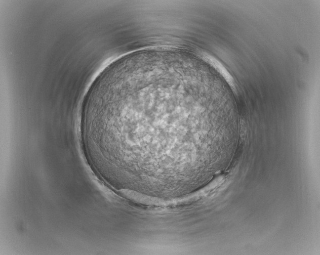 X0000115561099200911201817