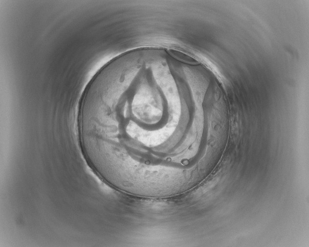 X0000115561103200911201817