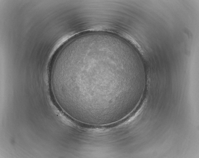 X0000115561122200911201817