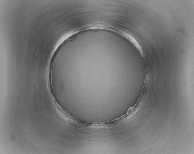 X0000115561146200911201817