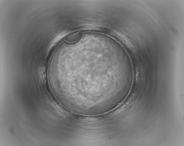 X0000115561164200911201816