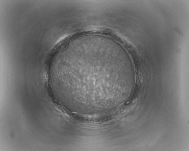 X0000115561206200911201815