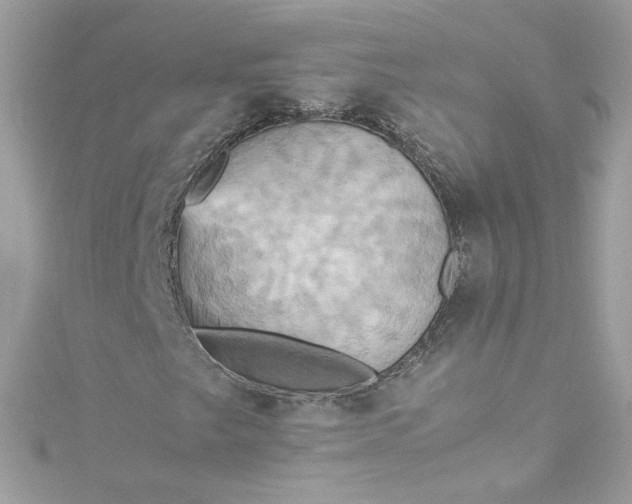 X0000115561249200911201815