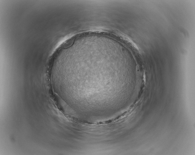 X0000115561256200911201815