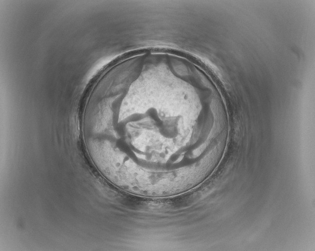 X0000115561271200911201815