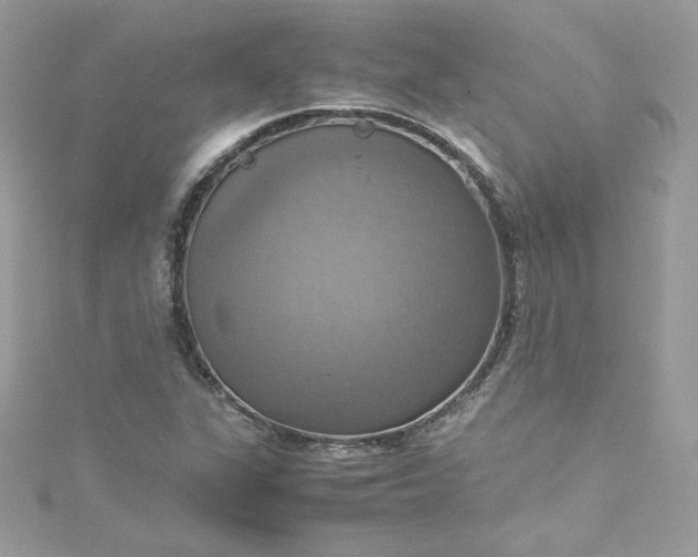 X0000115561311200911201814