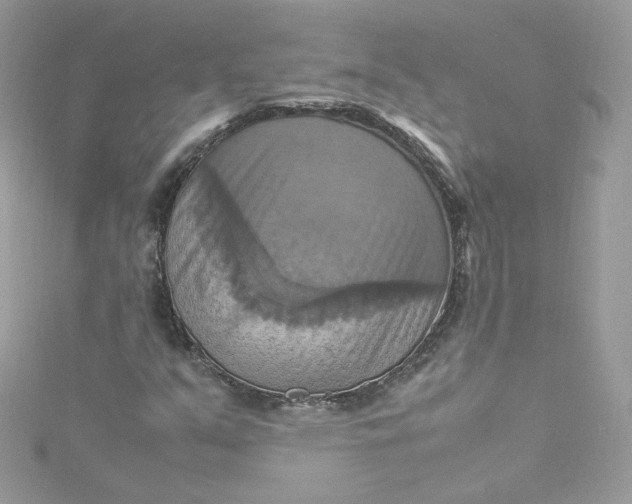 X0000115561351200911201814