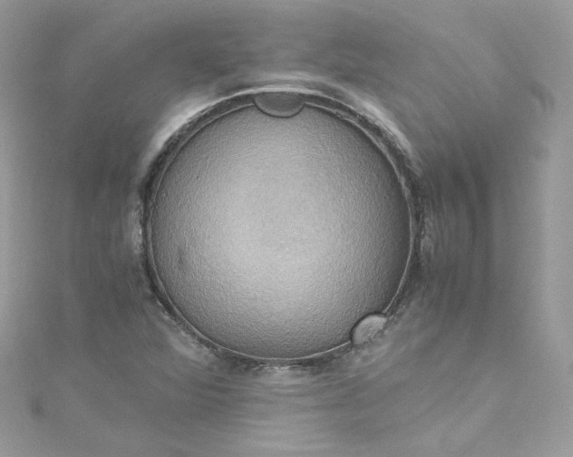 X0000115561360200911201814