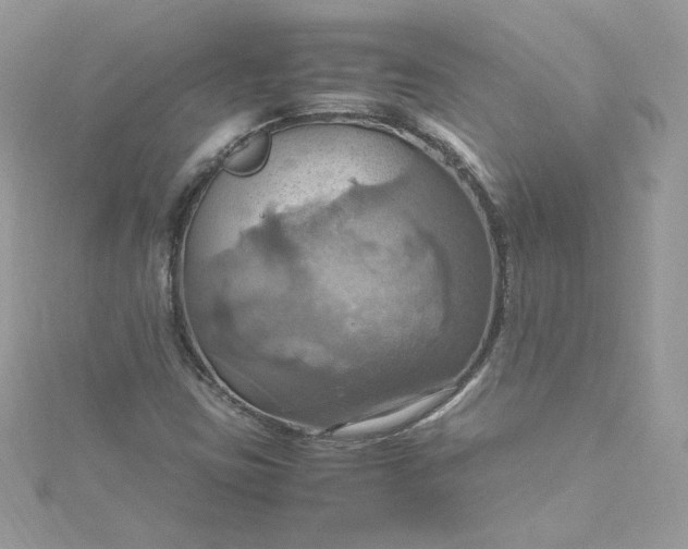 X0000115561403200911201813